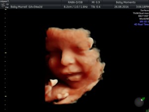 34 baby scan berkshire 